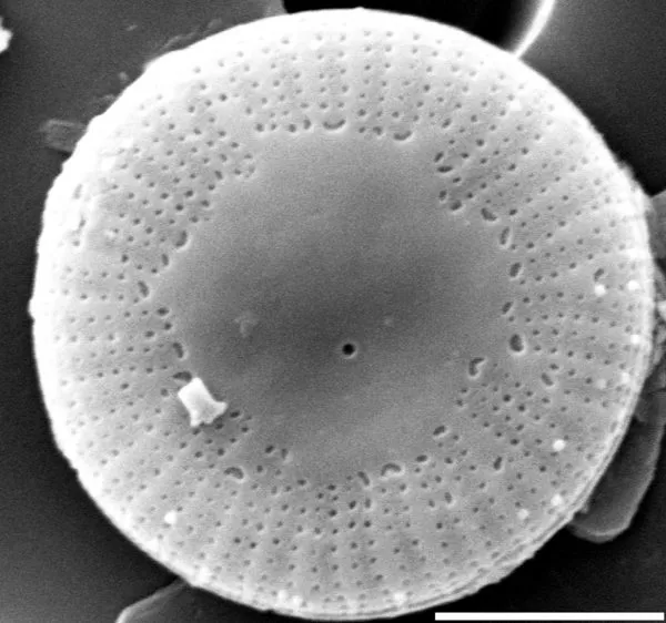 Diatoms with round, tiny radial symmetry can usually only be determined with a scanning electron microscope because of their minuscule size.