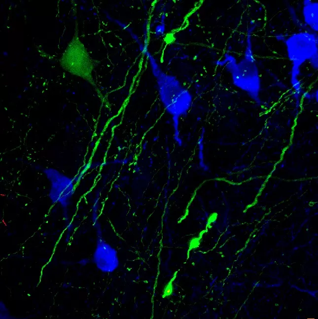 Hungarian researchers first in world to identify two types of cholinergic neurons in the basal forebrain