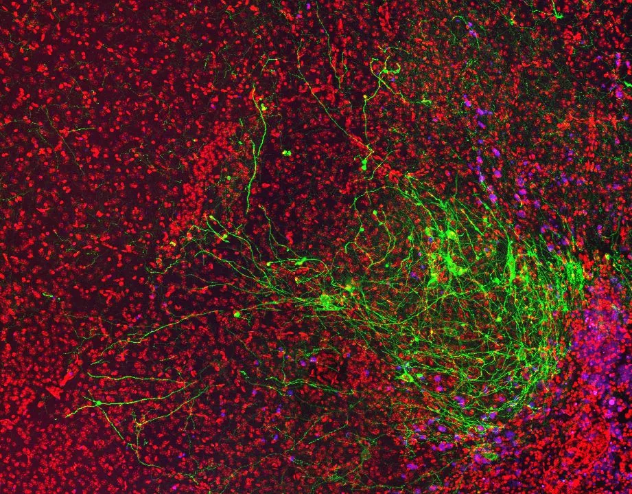 Hungarian researchers first in world to identify two types of cholinergic neurons in the basal forebrain