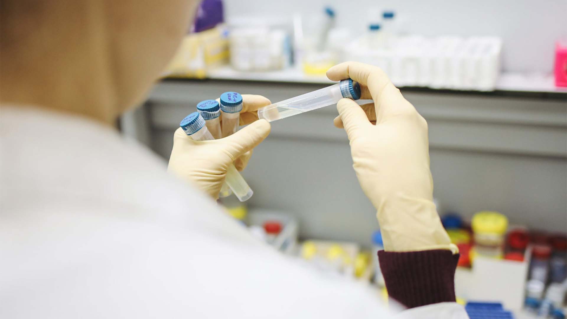 Coronavirus may also affect the functioning of brain