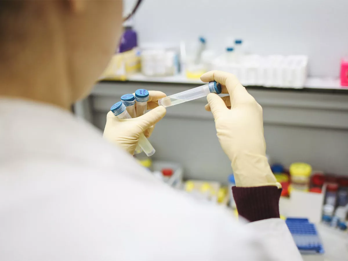 Coronavirus may also affect the functioning of brain