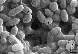 Carbonate precipitation on the surface of cultivated bacteria (black arrows)