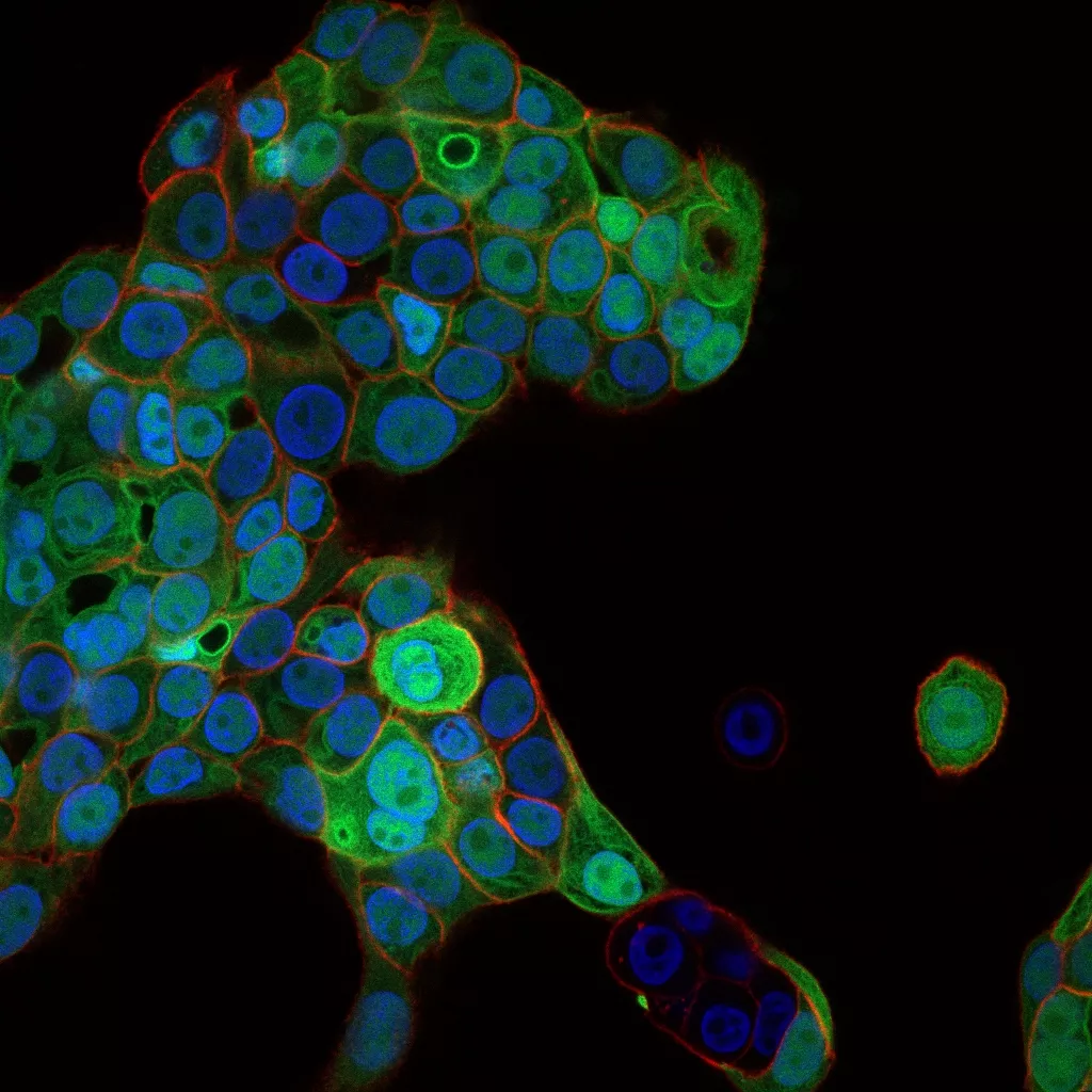 Researchers of TTK have collaborated on developing a new procedure to accelerate cancer diagnosis and identify different types of cancer cells