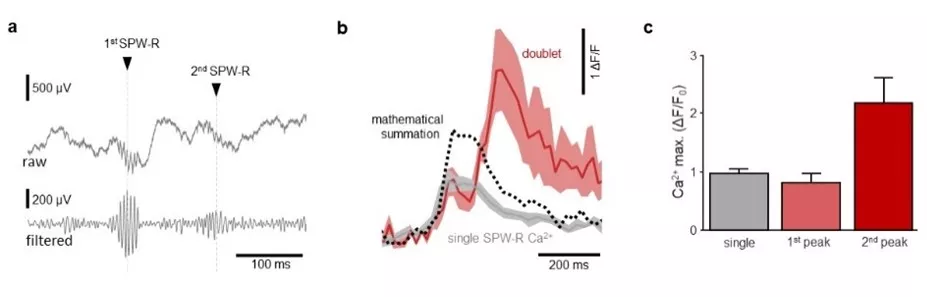 IEM -Hungarian researchers uncovered a new aspect of neuronal plasticity