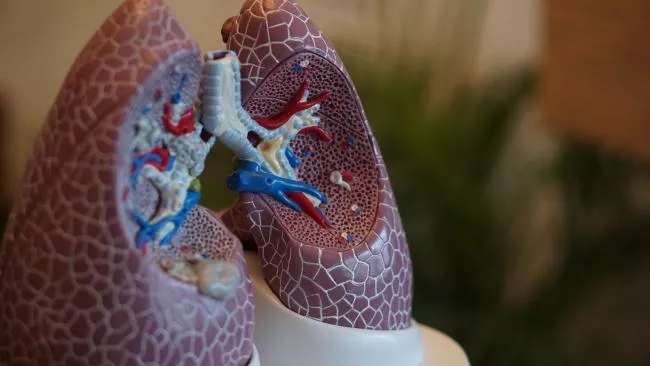 New Software Using Artificial Intelligence Analysis May Become a Milestone in Diagnosing Lung Cancer
