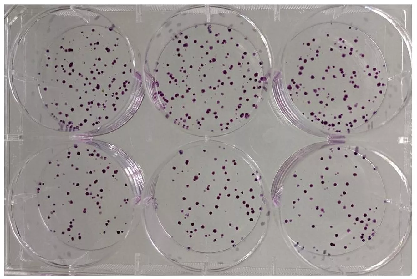 Researchers from EK-CER and the University of Cambridge used new methods to analyze the experimental data of previous studies on the effect of cell irradiation