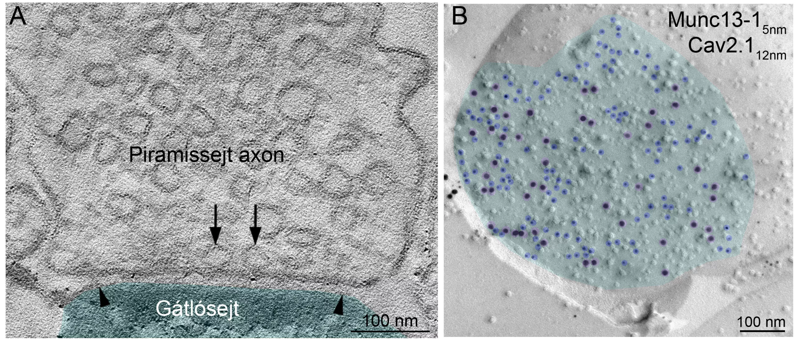 IEM researchers have discovered the mechanism that sets excitatory synaptic strength