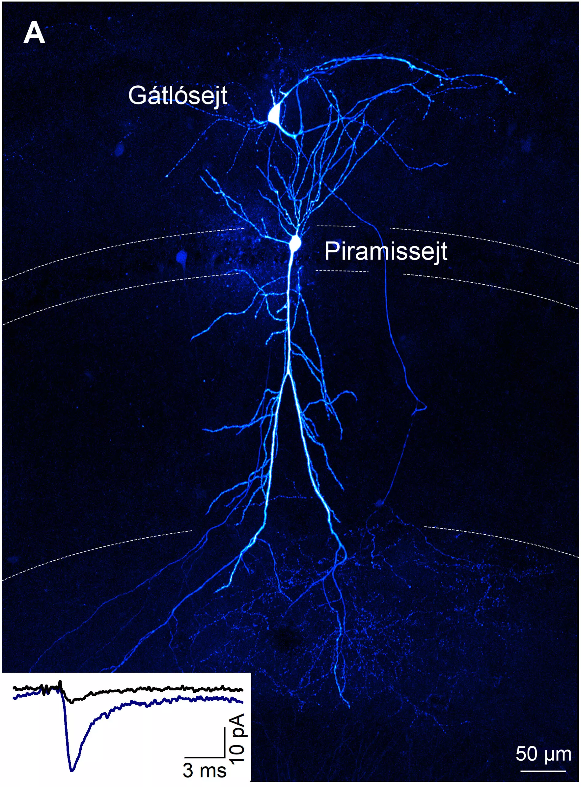IEM researchers have discovered the mechanism that sets excitatory synaptic strength