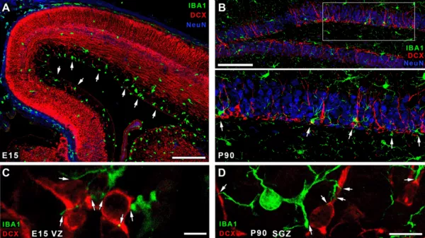 Nurturing developing neurons: How microglia, the main immune cells of the brain contribute to brain development by interacting with newborn neurons