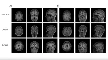 Recent results of RCNS researchers demonstrate that applying deep learning methods can improve quality control of MR images