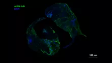 BRC Researchers investigated the role of bacterial toxins in the evolution of innate immunity in an international collaboration