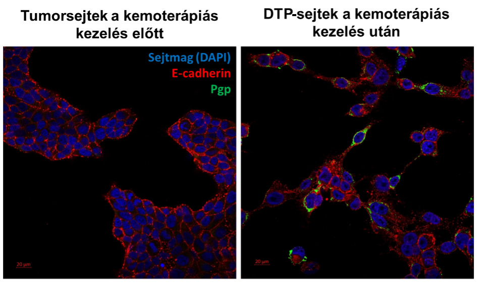 Új támadáspontot azonosítottak a HUN-REN TTK kutatói a kemoterápiát túlélő tumorsejtekben