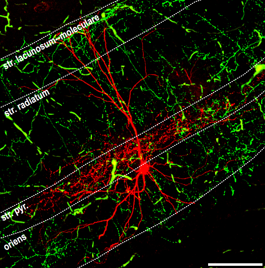 The new discovery by HUN-REN IEM researchers reveals the coordinating processes of memory multiplexing considered one of the brain’s peak performances