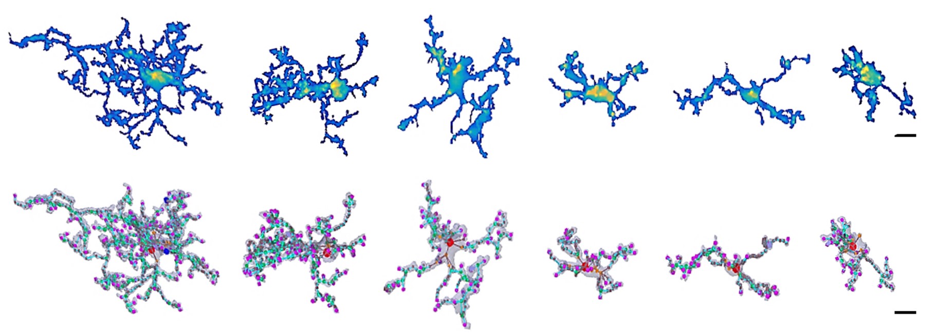 Laboratory of Neuroimmunology - New Discovery by IEM Researchers Could Improve Understanding of Brain Disease Mechanisms of the HUN-REN Institute of Experimental Medicine - 