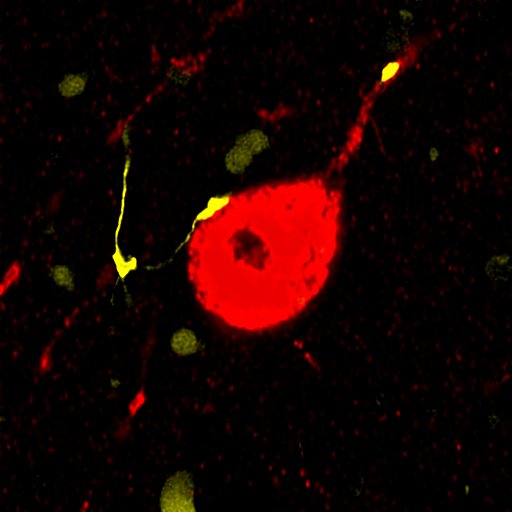 A HUN-REN Kísérleti Orvostudományi Kutatóintézet (HUN-REN KOKI) Dr. Hangya Balázs vezetésével működő Rendszer-neurobiológia kutatócsoportjának tagjai mélyagyi gátlósejteket vizsgálva megfigyelték, hogy e sejtek aktivitásának blokkolá