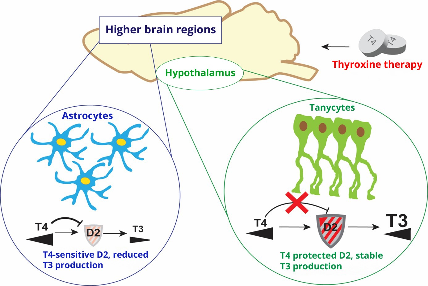 IEM brain fog