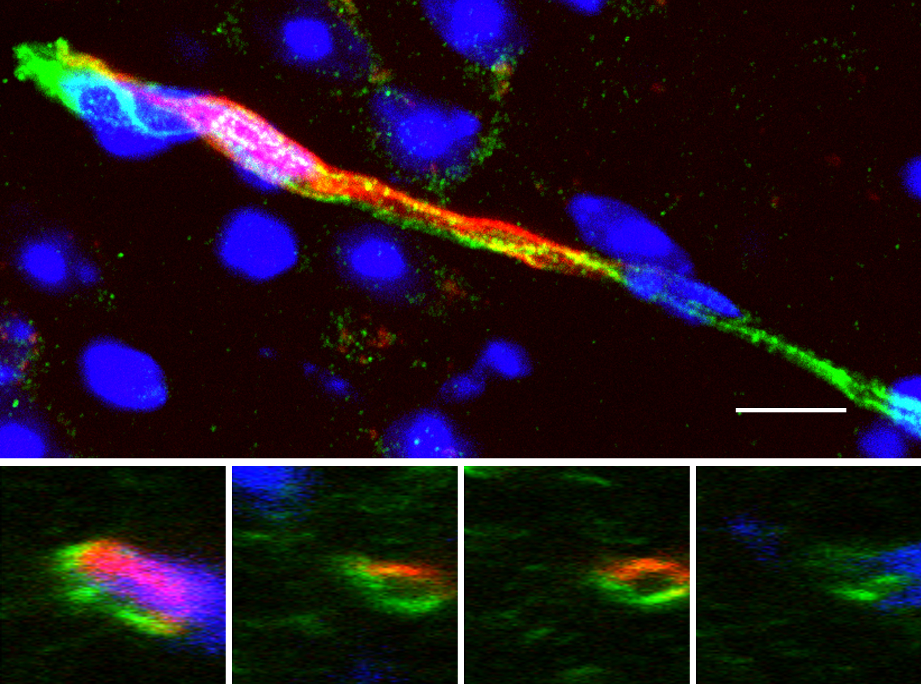 BRC Age-Related Cerebrovascular Changes