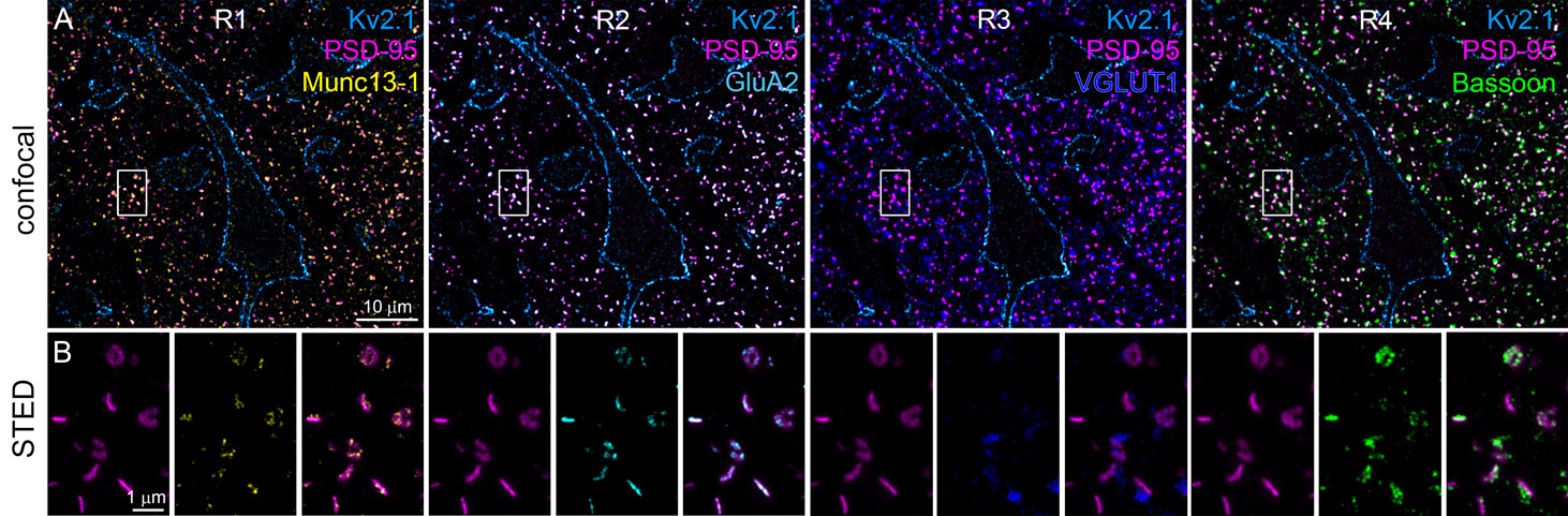Áttörést hozhat a HUN-REN kutatóinak eljárása a skizofrénia megértésben