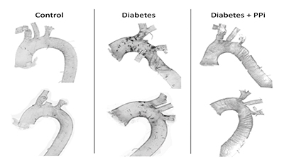 Project No.: ELKH-POC-2022-011, Title: „Toward a Prevention Therapy of Diabetes-Associated Calification”